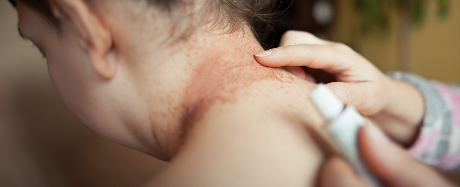Dermatology Section